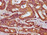 HOOK3 Antibody in Immunohistochemistry (Paraffin) (IHC (P))