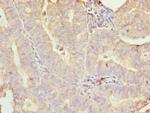 GALNT7 Antibody in Immunohistochemistry (Paraffin) (IHC (P))