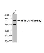 KBTBD6 Antibody in Western Blot (WB)