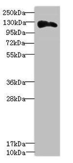 Anillin Antibody in Western Blot (WB)