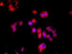 LDHD Antibody in Immunocytochemistry (ICC/IF)