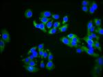 ZDHHC14 Antibody in Immunocytochemistry (ICC/IF)