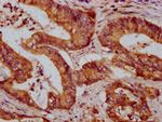 ZDHHC14 Antibody in Immunohistochemistry (Paraffin) (IHC (P))