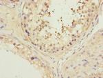 MFN1 Antibody in Immunohistochemistry (Paraffin) (IHC (P))