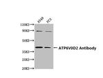 ATP6V0D2 Antibody in Western Blot (WB)