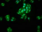 LACE1 Antibody in Immunocytochemistry (ICC/IF)