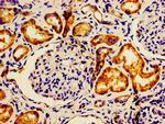 LACE1 Antibody in Immunohistochemistry (Paraffin) (IHC (P))