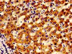 LACE1 Antibody in Immunohistochemistry (Paraffin) (IHC (P))