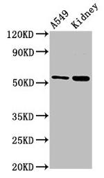 LACE1 Antibody in Western Blot (WB)