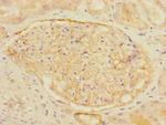 CD35 Antibody in Immunohistochemistry (Paraffin) (IHC (P))