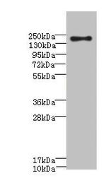 CD35 Antibody in Western Blot (WB)