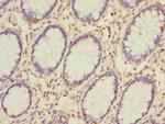 GSDMB Antibody in Immunohistochemistry (Paraffin) (IHC (P))