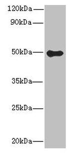 GSDMB Antibody in Western Blot (WB)