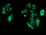 TBC1D15 Antibody in Immunocytochemistry (ICC/IF)