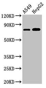 TBC1D15 Antibody in Western Blot (WB)