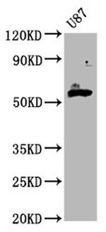 GPT2 Antibody in Western Blot (WB)