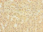 DIS3L Antibody in Immunohistochemistry (Paraffin) (IHC (P))