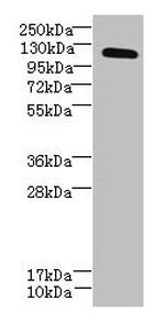 DIS3L Antibody in Western Blot (WB)