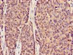 SLC20A1 Antibody in Immunohistochemistry (Paraffin) (IHC (P))