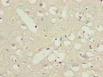 PPP2R3C Antibody in Immunohistochemistry (Paraffin) (IHC (P))