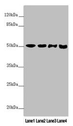 PPP2R3C Antibody in Western Blot (WB)