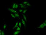 L3MBTL2 Antibody in Immunocytochemistry (ICC/IF)