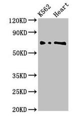 L3MBTL2 Antibody in Western Blot (WB)