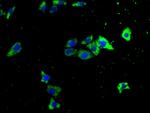 ITCH Antibody in Immunocytochemistry (ICC/IF)