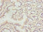 LLCFC1 Antibody in Immunohistochemistry (Paraffin) (IHC (P))