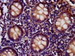 CD99L2 Antibody in Immunohistochemistry (Paraffin) (IHC (P))