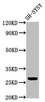 CD99L2 Antibody in Western Blot (WB)