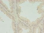 RQCD1 Antibody in Immunohistochemistry (Paraffin) (IHC (P))