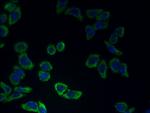 CATSPER2 Antibody in Immunocytochemistry (ICC/IF)