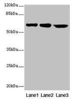 CATSPER2 Antibody in Western Blot (WB)