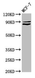 PCQAP Antibody in Western Blot (WB)