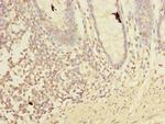 LMO3 Antibody in Immunohistochemistry (Paraffin) (IHC (P))