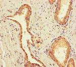 UBE2Q2 Antibody in Immunohistochemistry (Paraffin) (IHC (P))