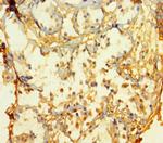 ATOH1 Antibody in Immunohistochemistry (Paraffin) (IHC (P))