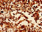 Lass5 Antibody in Immunohistochemistry (Paraffin) (IHC (P))