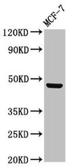 Lass5 Antibody in Western Blot (WB)