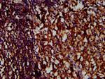 CD85j (ILT2) Antibody in Immunohistochemistry (Paraffin) (IHC (P))