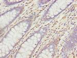 VANGL1 Antibody in Immunohistochemistry (Paraffin) (IHC (P))