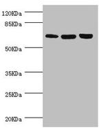 CTNNBL1 Antibody in Western Blot (WB)