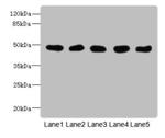 GCDH Antibody in Western Blot (WB)