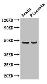 CD177 Antibody in Western Blot (WB)