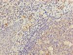 KIR3DL3 Antibody in Immunohistochemistry (Paraffin) (IHC (P))