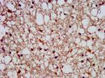 SLAIN1 Antibody in Immunohistochemistry (Paraffin) (IHC (P))