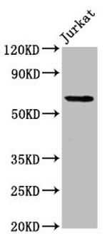 SLAIN1 Antibody in Western Blot (WB)