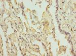 LILRB4 Antibody in Immunohistochemistry (Paraffin) (IHC (P))