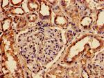 RABGGTA Antibody in Immunohistochemistry (Paraffin) (IHC (P))